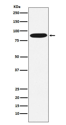 Anti-MST1 Rabbit Monoclonal Antibody Boster Bio