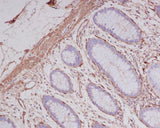Anti-alpha smooth muscle Actin ACTA2 Rabbit Monoclonal Antibody Boster Bio