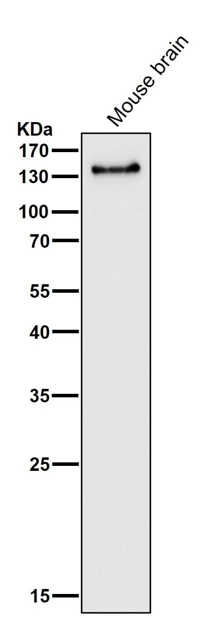 Anti-PER2 Rabbit Monoclonal Antibody Boster Bio