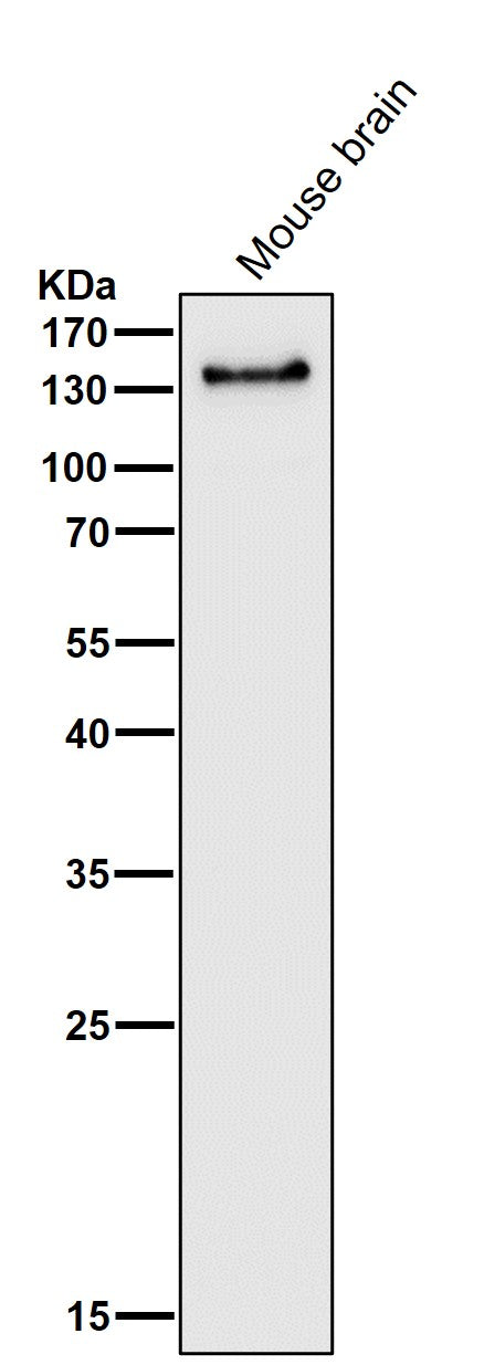 Anti-PER2 Rabbit Monoclonal Antibody Boster Bio
