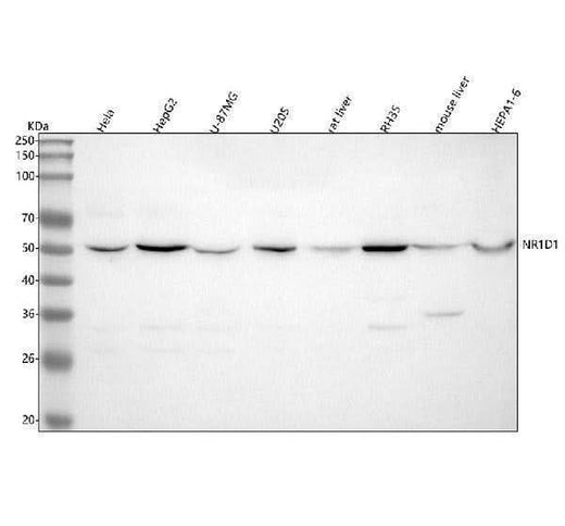 Anti-NR1D1 Rabbit Monoclonal Antibody Boster Bio