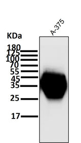 Anti-CD63 Rabbit Monoclonal Antibody Boster Bio