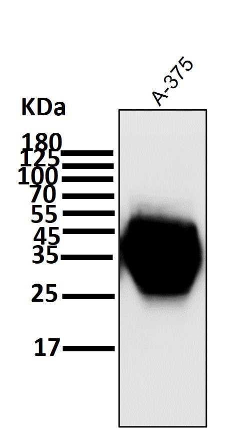 Anti-CD63 Rabbit Monoclonal Antibody Boster Bio