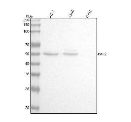 Anti-PAR2 Rabbit Monoclonal Antibody Boster Bio