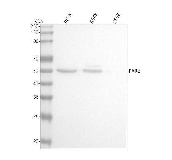 Anti-PAR2 Rabbit Monoclonal Antibody Boster Bio