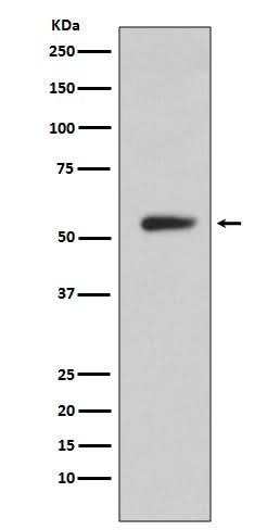 Anti-CA9/Ca Ix Rabbit Monoclonal Antibody Boster Bio