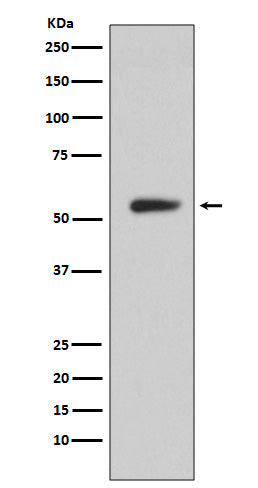 Anti-CA9/Ca Ix Rabbit Monoclonal Antibody Boster Bio