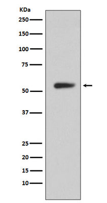 Anti-CA9/Ca Ix Rabbit Monoclonal Antibody Boster Bio