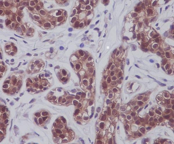 Anti-STAT5A/B Rabbit Monoclonal Antibody Boster Bio