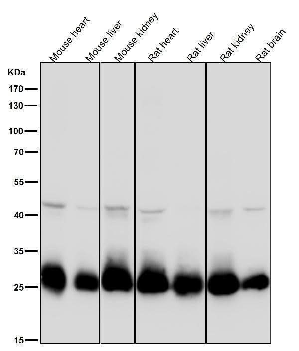 Anti-SDHB Rabbit Monoclonal Antibody Boster Bio