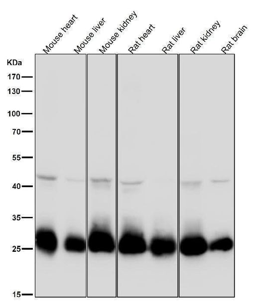 Anti-SDHB Rabbit Monoclonal Antibody Boster Bio