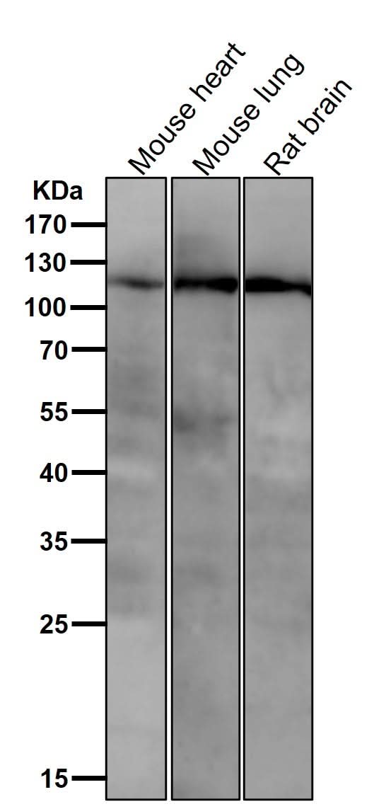 Anti-PI3 Kinase p110 beta Rabbit Monoclonal Antibody Boster Bio