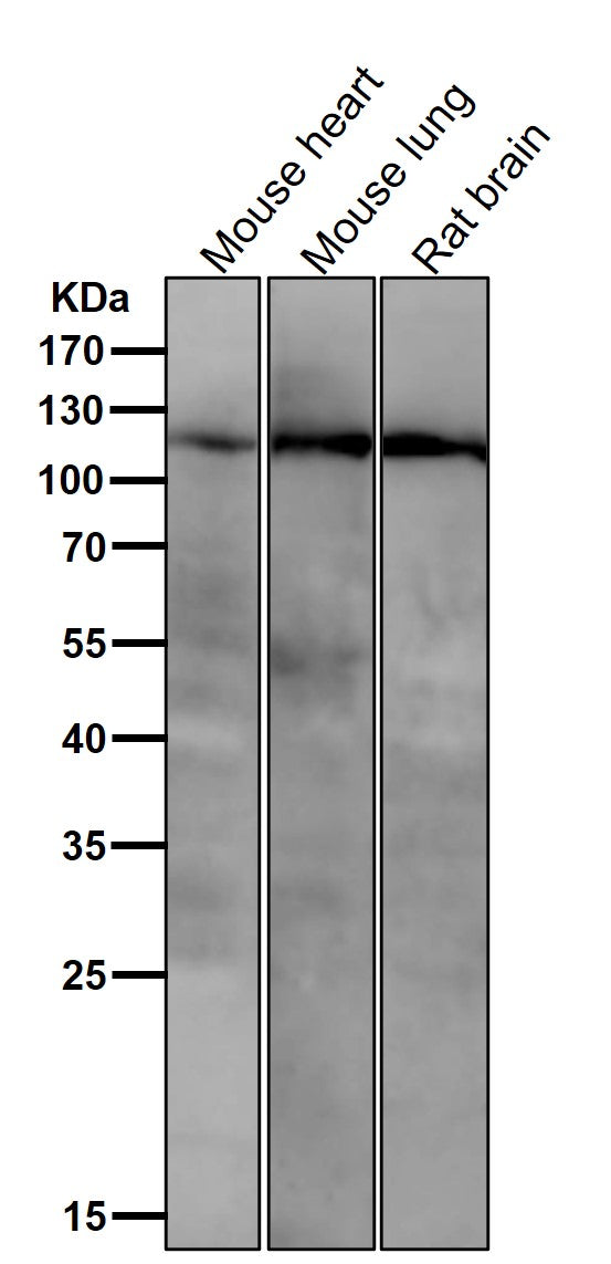 Anti-PI3 Kinase p110 beta Rabbit Monoclonal Antibody Boster Bio