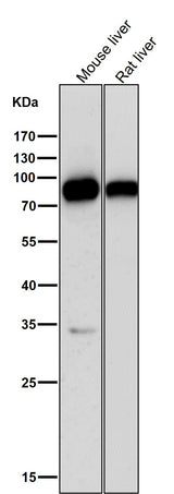 Anti-SCARB1/Sr Bi Rabbit Monoclonal Antibody Boster Bio