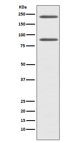 Anti-C4 Rabbit Monoclonal Antibody Boster Bio