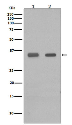 Anti-CEBP Beta Rabbit Monoclonal Antibody Boster Bio