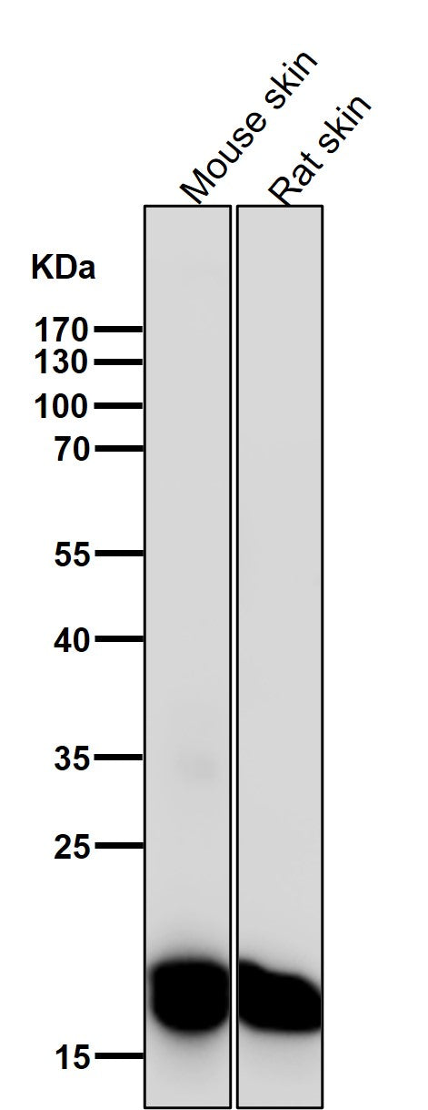 Anti-CEBP beta Rabbit Monoclonal Antibody Boster Bio