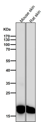 Anti-CEBP beta Rabbit Monoclonal Antibody Boster Bio