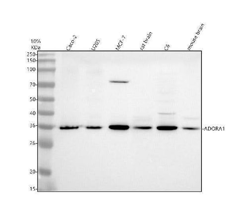 Anti-ADORA1 Rabbit Monoclonal Antibody Boster Bio