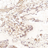 Anti-CD41 ITGA2B Rabbit Monoclonal Antibody Boster Bio