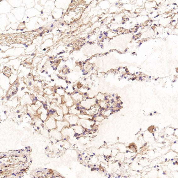 Anti-CD41 ITGA2B Rabbit Monoclonal Antibody Boster Bio