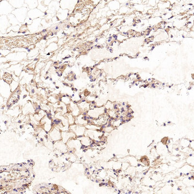 Anti-CD41 ITGA2B Rabbit Monoclonal Antibody Boster Bio