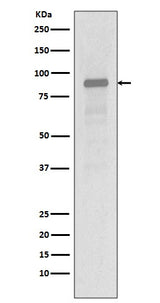 Anti-Hsp90 alpha HSP90AA1 Rabbit Monoclonal Antibody Boster Bio