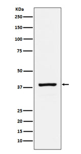 Anti-RASSF1 Rabbit Monoclonal Antibody Boster Bio