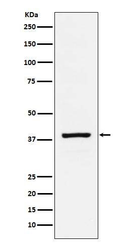Anti-RASSF1 Rabbit Monoclonal Antibody Boster Bio