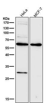 Anti-PDCD4 Rabbit Monoclonal Antibody Boster Bio