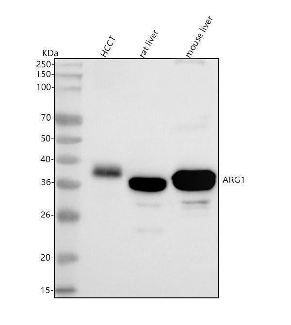 Anti-ARG1/Arginase 1 Rabbit Monoclonal Antibody Boster Bio
