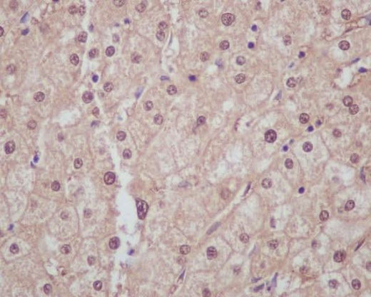 Anti-Liver Arginase ARG1 Rabbit Monoclonal Antibody Boster Bio
