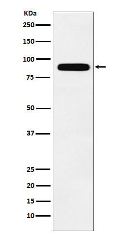 Anti-Tbx3 Rabbit Monoclonal Antibody Boster Bio