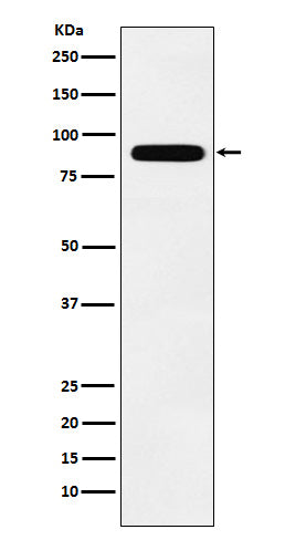 Anti-Tbx3 Rabbit Monoclonal Antibody Boster Bio