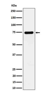 Anti-Dopamine beta Hydroxylase Rabbit Monoclonal Antibody Boster Bio