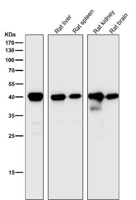 Anti-CD40L CD40LG Rabbit Monoclonal Antibody Boster Bio