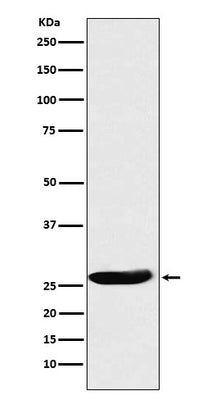 Anti-CLPP Rabbit Monoclonal Antibody Boster Bio