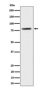 Anti-TORC2 Rabbit Monoclonal Antibody Boster Bio