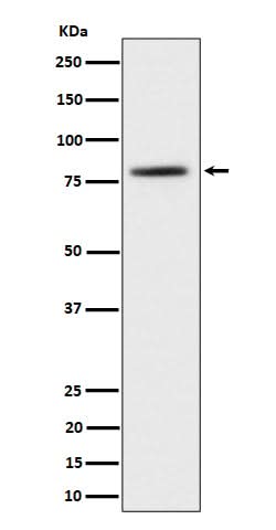 Anti-TORC2 Rabbit Monoclonal Antibody Boster Bio