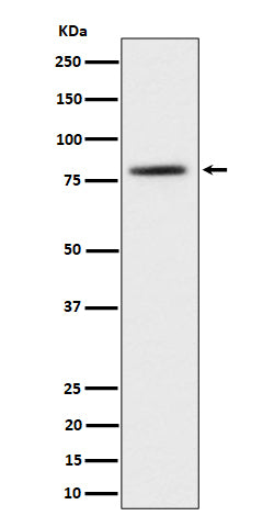 Anti-TORC2 Rabbit Monoclonal Antibody Boster Bio