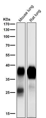 Anti-Podoplanin PDPN Rabbit Monoclonal Antibody Boster Bio