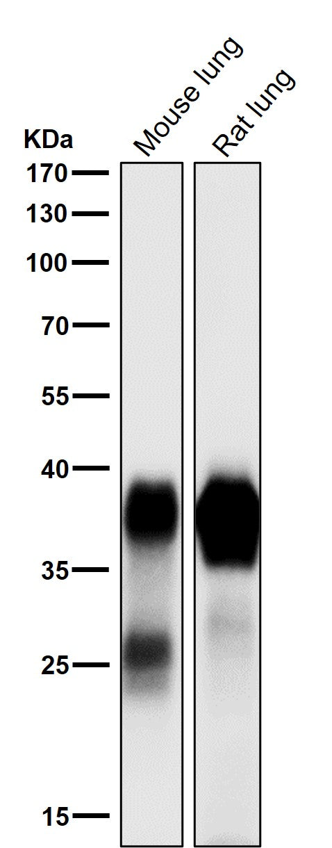 Anti-Podoplanin PDPN Rabbit Monoclonal Antibody Boster Bio
