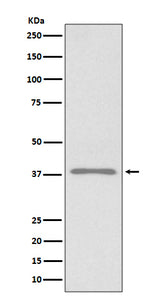 Anti-Podoplanin PDPN Rabbit Monoclonal Antibody Boster Bio