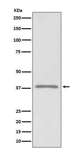 Anti-Podoplanin PDPN Rabbit Monoclonal Antibody Boster Bio