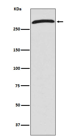 Anti-CHD4 Rabbit Monoclonal Antibody Boster Bio