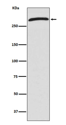Anti-CHD4 Rabbit Monoclonal Antibody Boster Bio