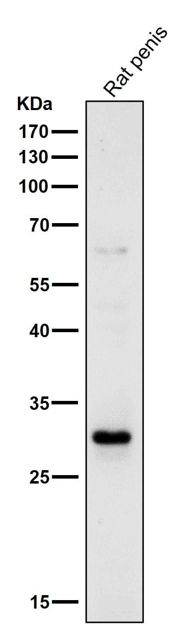 Anti-14-3-3 sigma SFN Rabbit Monoclonal Antibody Boster Bio