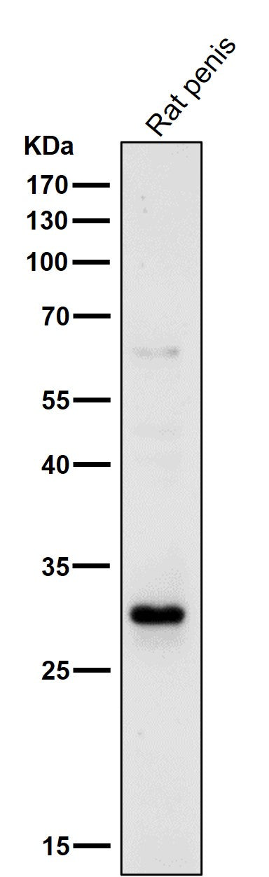 Anti-14-3-3 sigma SFN Rabbit Monoclonal Antibody Boster Bio
