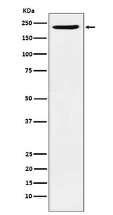 Anti-PBRM1 Rabbit Monoclonal Antibody Boster Bio