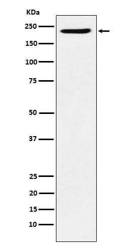Anti-PBRM1 Rabbit Monoclonal Antibody Boster Bio